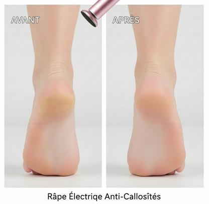 Râpe Électrique Anti-Callosités